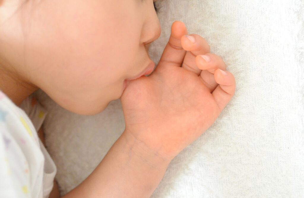 子どもの出っ歯の原因