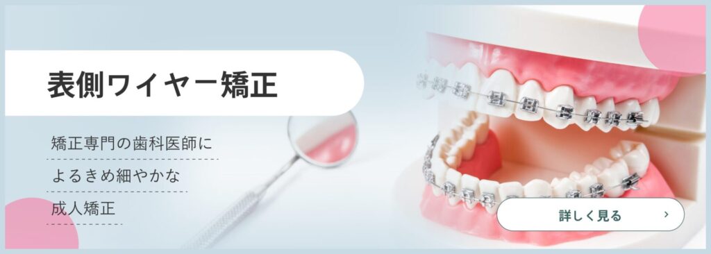 表側ワイヤー矯正