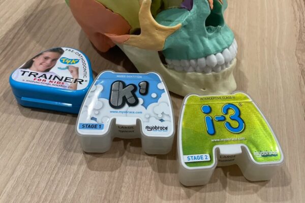 マイオブレース治療の流れ